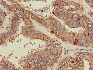 RPL19 / Ribosomal Protein L19 Antibody