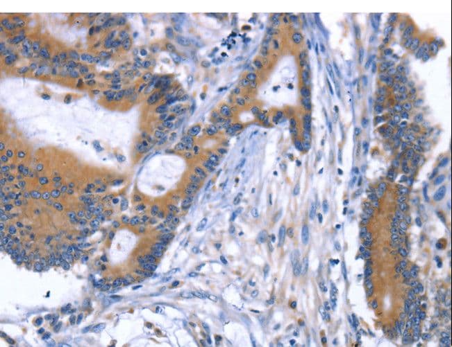 ARRB1 / Beta Arrestin 1 Antibody
