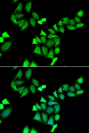 Polyclonal Rabbit anti-Human GALE / UDP-Glucose 4-Epimerase Antibody (IHC, IF, WB)
