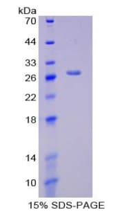 Human CKMT1A Protein (Recombinant His-T7)