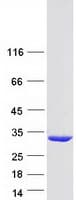 Human GSTM5-5 / GSTM5 Protein (Recombinant Myc-DDK (Flag))