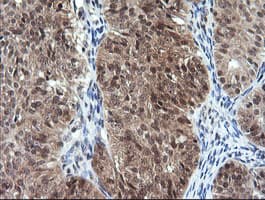 DDT / Dopamine Tautomerase Antibody (clone OTI1H3)