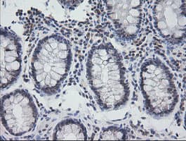 NKIRAS1 Antibody (clone OTI6C11)