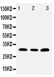Polyclonal Rabbit anti-Human TOLLIP Antibody (aa224-243, IHC, WB)