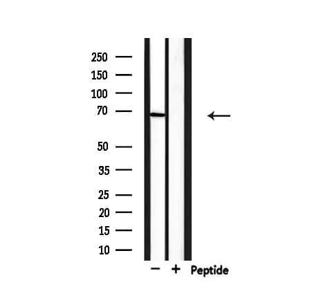 PIAS3 Antibody