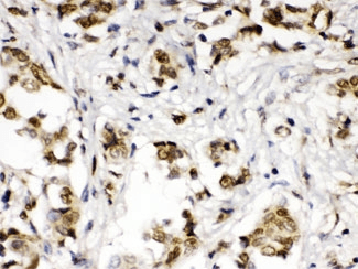 ABR Antibody