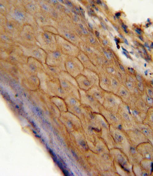 Polyclonal Rabbit anti-Human CNR2 / CB2 Antibody (aa329-356, IHC, WB)