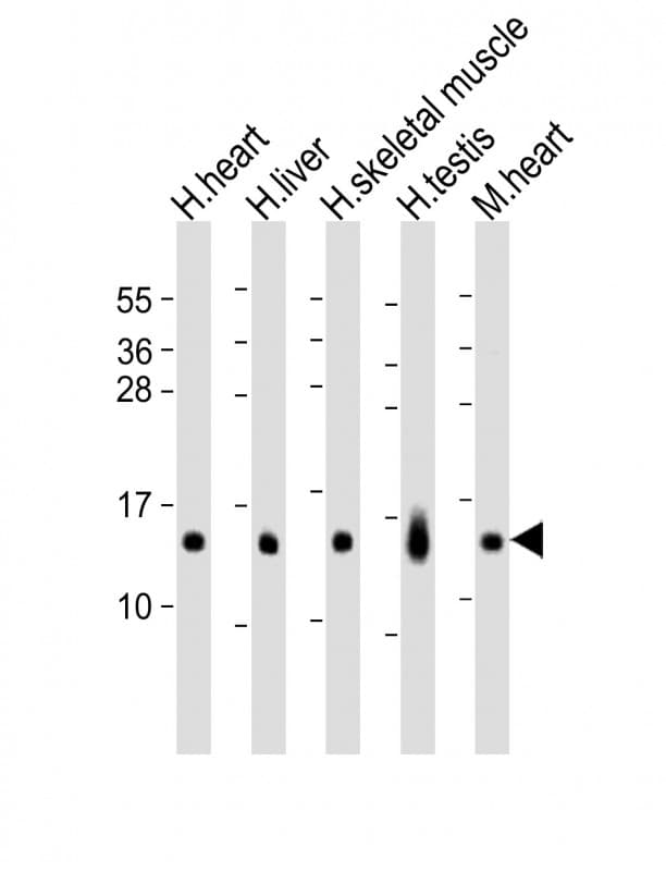 Polyclonal Rabbit anti-Human RNF7 Antibody (aa25-57, IHC, WB)