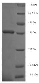Mouse ITGB1 / Integrin Beta 1 / CD29 Protein (Recombinant 6His, N-terminus)