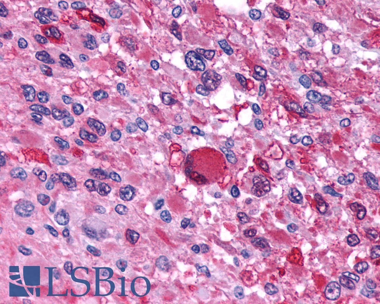 PathPlus™ AVPR1B Antibody (N-Terminus)
