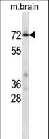 Polyclonal Rabbit anti-Mouse CDK17 / PCTK2 / PCTAIRE2 Antibody (aa484-513, WB)