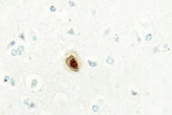 Polyclonal Rabbit anti-Human BUB3 Antibody (His274, IHC, IF, WB)