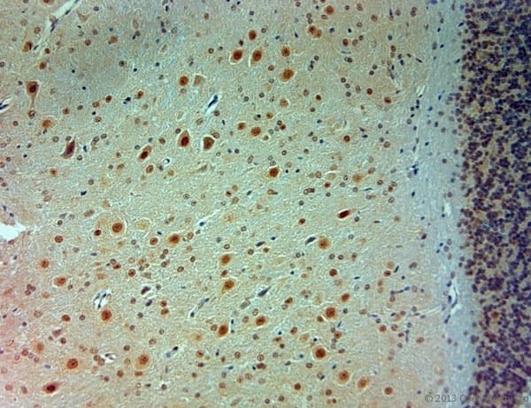 ARX Antibody (aa2-50)