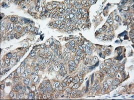 BDH2 Antibody (clone OTI2G1)