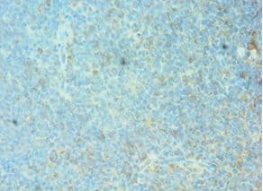 FRA-1 / FOSL1 Antibody (aa1-100)