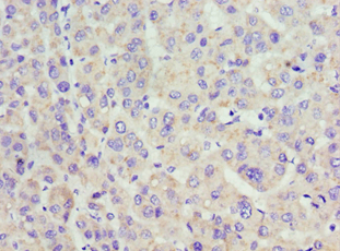 ACAA1 Antibody (aa27-300)