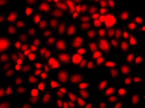 NR2E1 / TLX Antibody