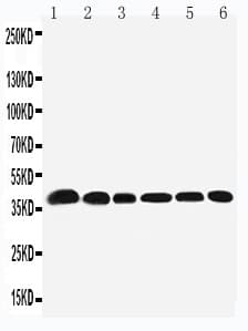 Polyclonal Rabbit anti-Human NPM1 / NPM / Nucleophosmin Antibody (aa22-41, IHC, WB)