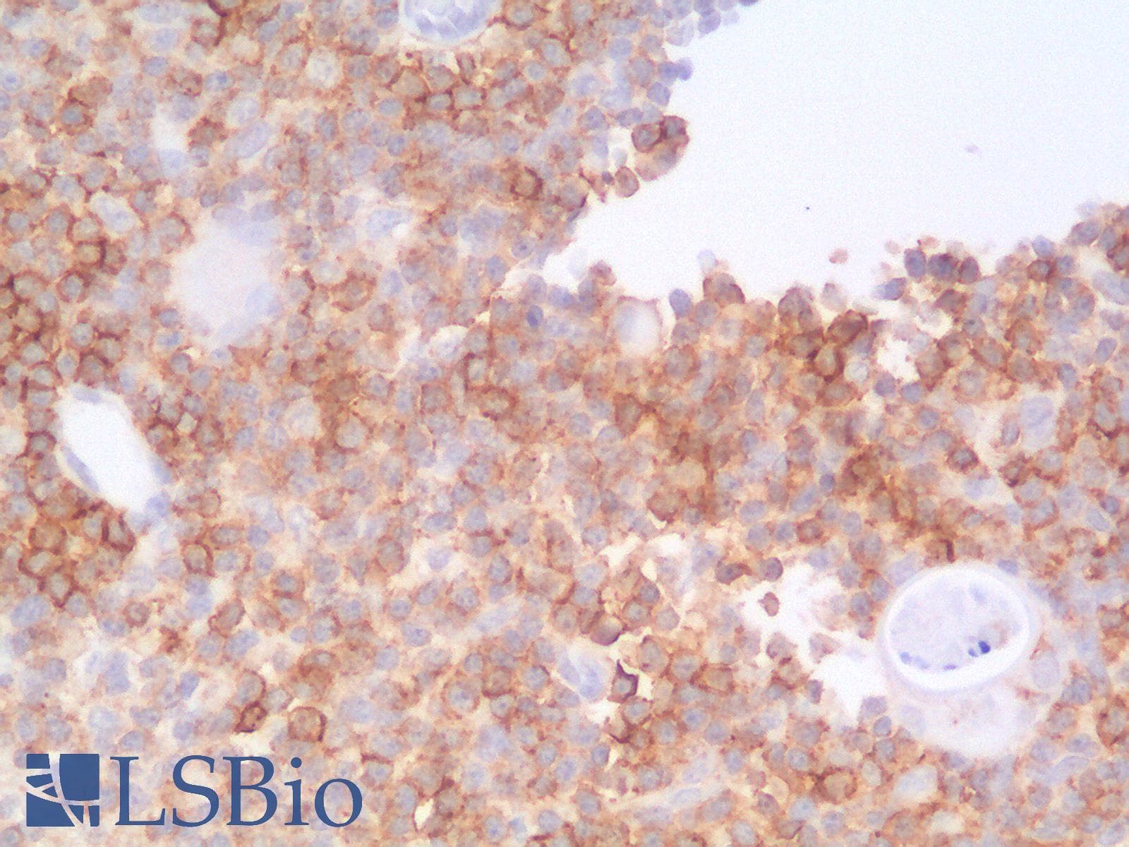 PathPlus™ SPN / CD43 Antibody (clone SPN/2049R)