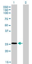 RNF141 Antibody (clone 6D9)