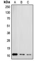 Polyclonal Rabbit anti-Human SNCG / Gamma-Synuclein Antibody (C-Terminus, IHC, WB)