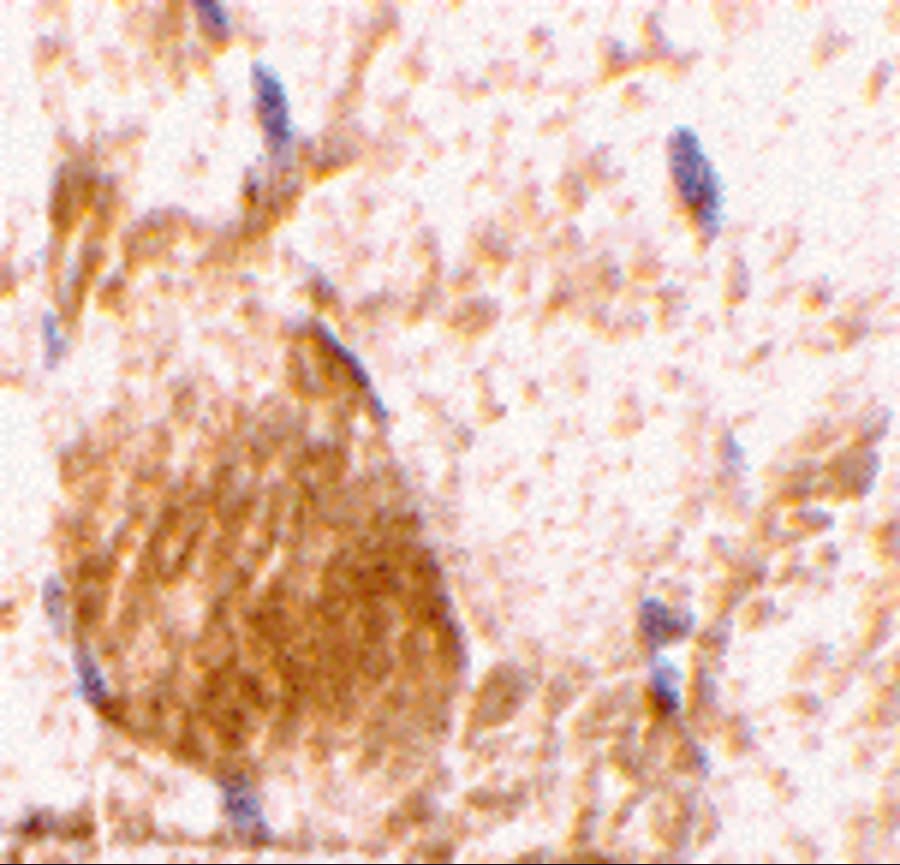 IL31 Antibody