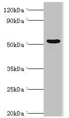 Polyclonal Rabbit anti-Human PRKAG3 / AMPK Gamma 3 Antibody (aa1-210, WB)