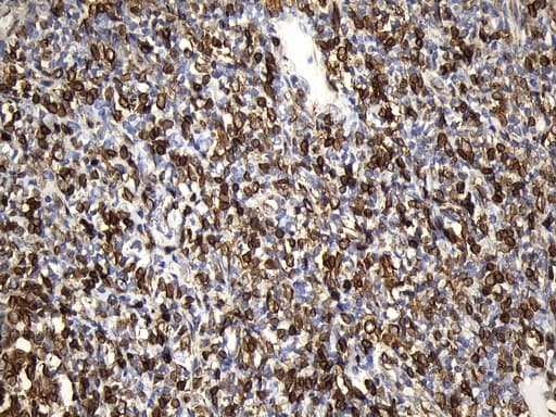 CD74 / CLIP Antibody (clone UMAB232, Carrier-free)