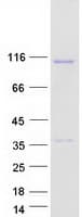Human GCC1 / GCC88 Protein (Recombinant Myc-DDK (Flag))