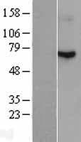 Human RDX / Radixin Protein (Over-Expression Lysate Myc-DDK (Flag))