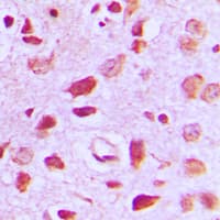 EIF5B / IF2 Antibody (C-Terminus)