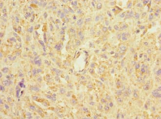 Polyclonal Rabbit anti-Human ACCN3 / ASIC3 Antibody (IHC, WB)