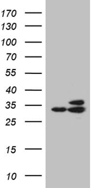 Monoclonal Mouse anti-Human RPL7A / Ribosomal Protein L7a Antibody (clone OTI3C5, aa2-266, IHC, WB)