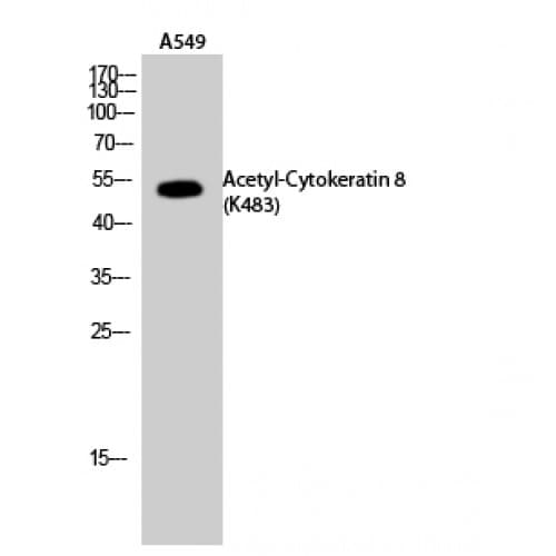 Polyclonal Rabbit anti-Human KRT8 / CK8 / Cytokeratin 8 Antibody (acetylation site of K483., WB)