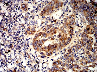 Monoclonal Mouse anti-Human ALK2 / ACVR1 Antibody (clone 2E2C11, IHC, WB)