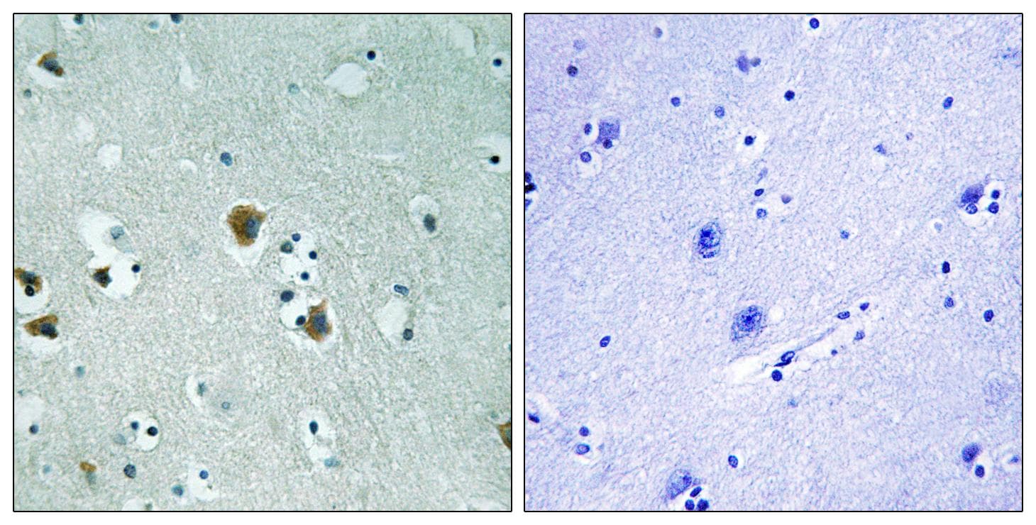 DPYSL2 / CRMP2 Antibody (p509)