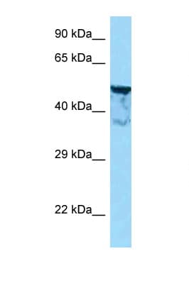 SHOOTIN1 / KIAA1598 Antibody (N-Terminus)