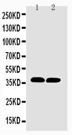 MT-CO1 / COX1 Antibody (aa501-514)