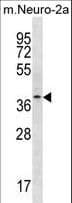 THOC6 Antibody (aa96-123)