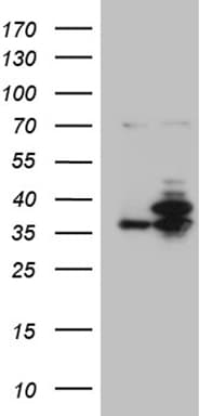 PPP4C Antibody (clone OTI2E4)