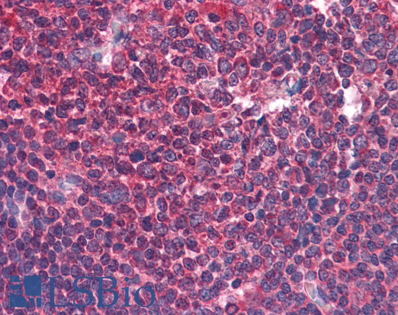 IHC-plus™ BIRC3 / cIAP2 Antibody