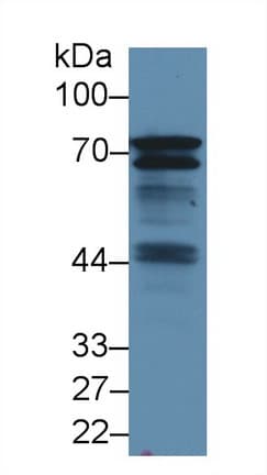 BLNK Antibody (aa65-314)