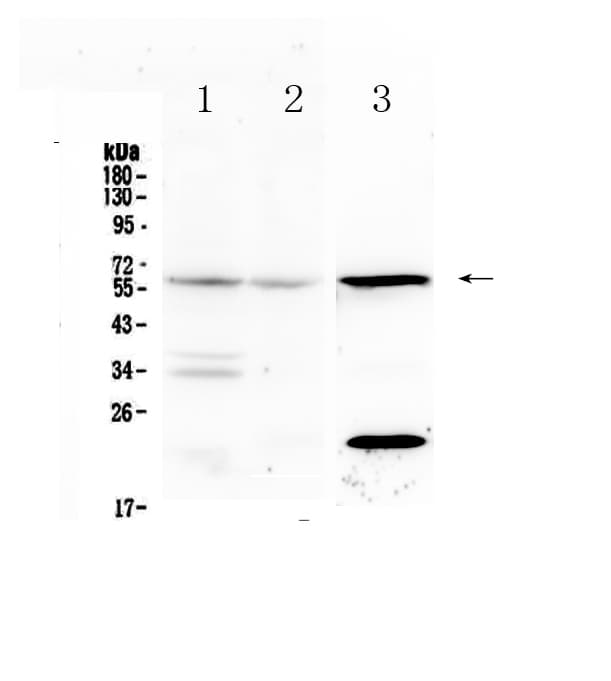 Polyclonal Rabbit anti-Mouse IL23R Antibody (WB)