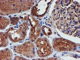IDS / Iduronate 2 Sulfatase Antibody (clone OTI4G2)