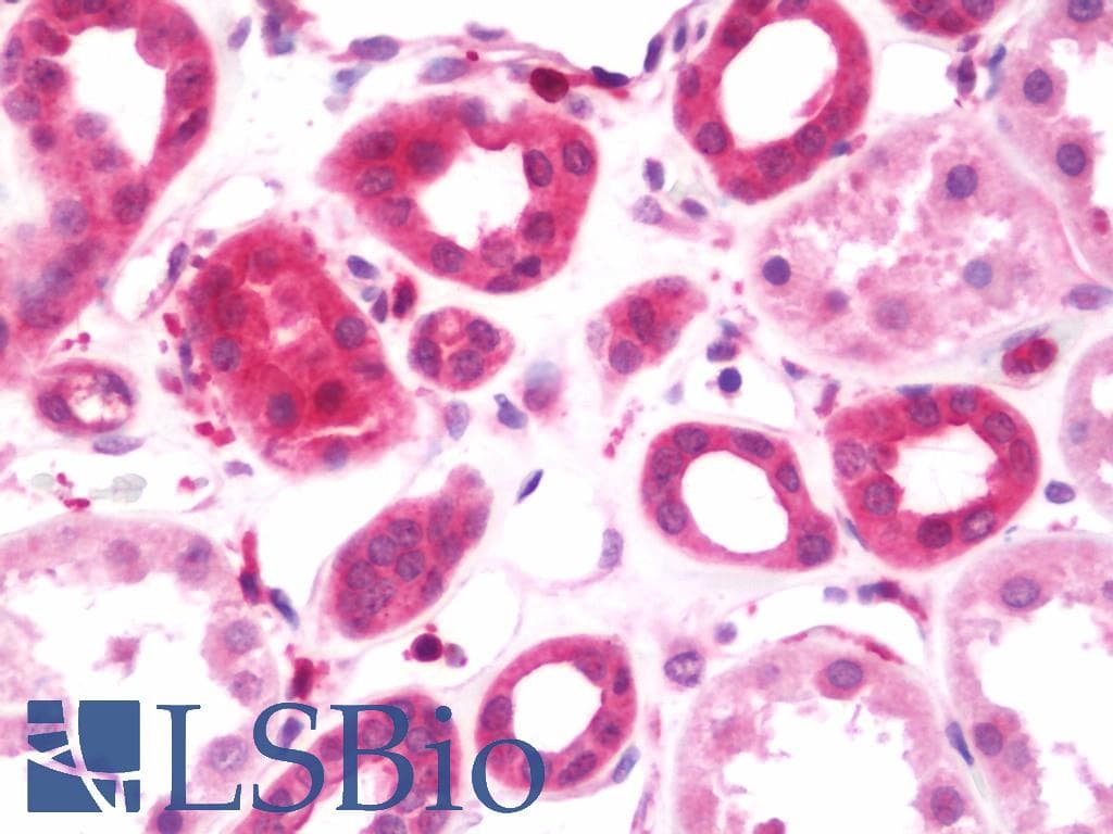 IHC-plus™ KRR1 Antibody (aa47-344)
