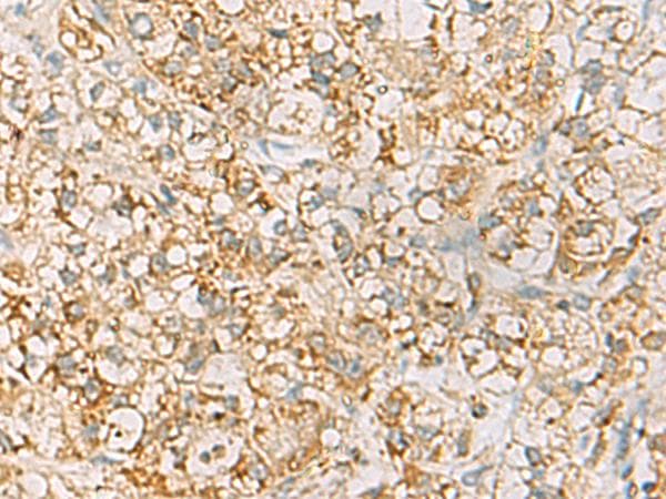 Polyclonal Rabbit anti-Human HLA-DQB2 Antibody (IHC)