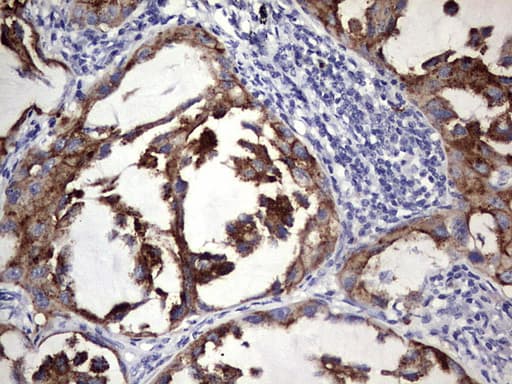 BFSP1 / Filensin Antibody (aa405-665, clone OTI2D2)