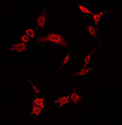 MOBKL2B / MOB3B Antibody
