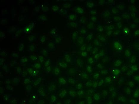 RAD51C Antibody
