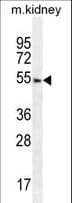 FBXO24 Antibody (aa118-145)